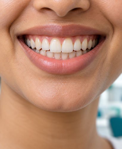 clean-gum-teeth Clean Gum