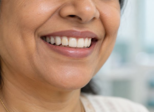 Clear Teeth
