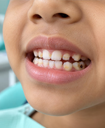 Dental Problem