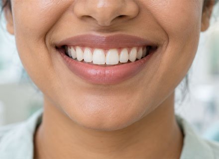 Perfect Smile